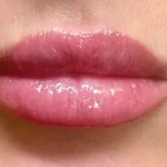 After Exion Face